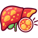 Fatty Liver